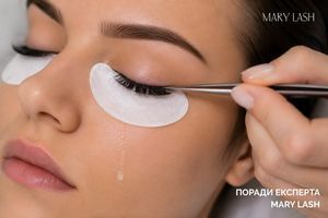 Слезятся глаза весной: можно ли делать наращивание ресниц во время сезонной аллергии фото